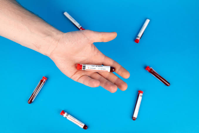 New AI Blood Test Could Warn of Heart Disease 15 Years Early